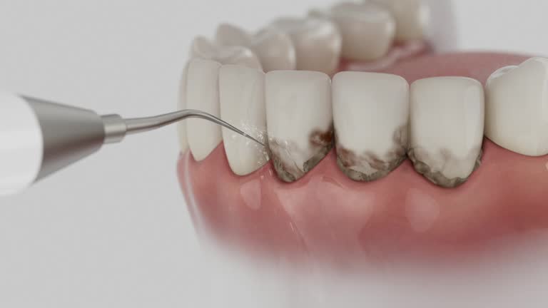 Reliable Teeth Whitening contractor in Stark County County, ND by Dentist Open Now
